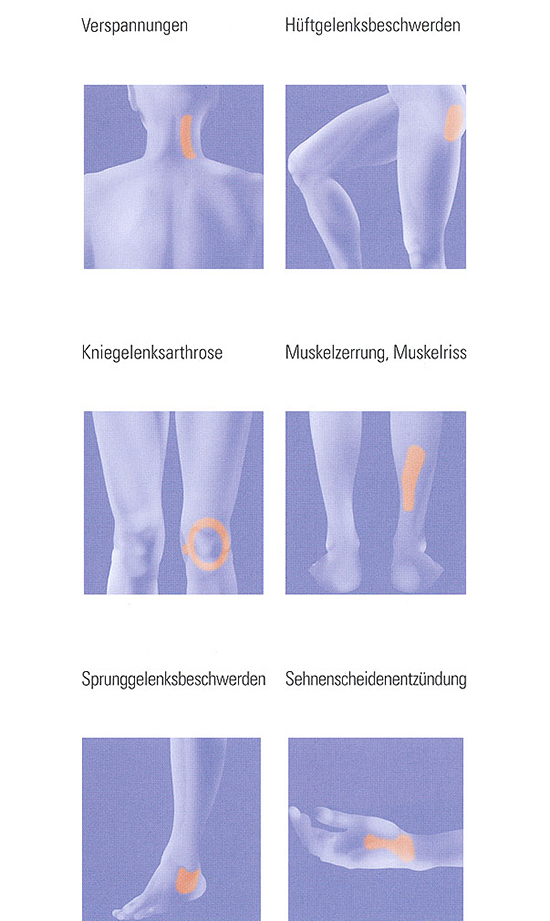 Lasertherapie - Facharzt für Orthopädie,
Chirotherapie & Akupunktur Dr. med. Dimitrios Pappas in 44787 Bochum